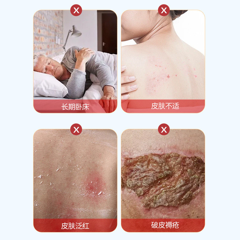 ขายร้อน#崎美玖川褥疮保健膏 Soothing Long-Term Bed Bed Mattresses Skin Redness Broken Skin Discomfort Ready St