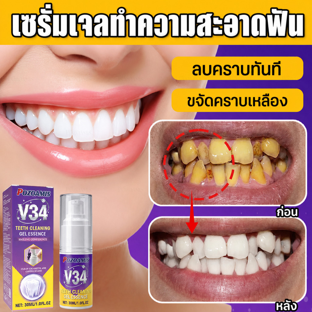 V34 Purple Tone Balancing Tooth Gel Serum Gentle Daily Oral Beauty สําหรับฟันเปลี่ยนสี