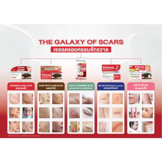 Puricas เพียวริก้าส์ Scar Gel (สินค้าตามตัวเลือก)