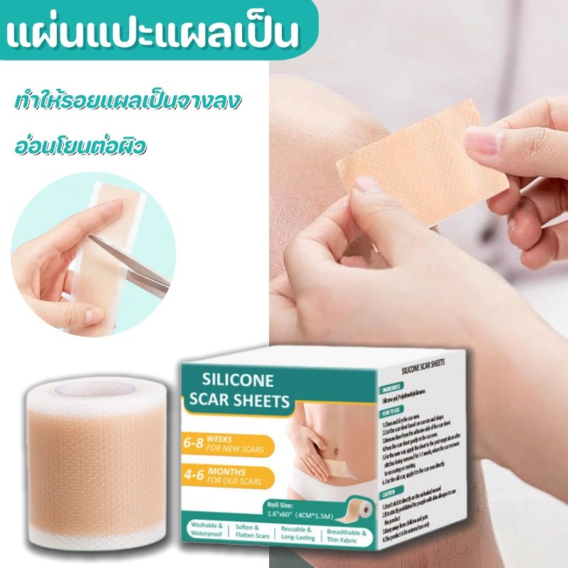 แผ่นแปะแผลเป็น กันน้ำ 4cm*150cm ทำให้รอยแผลเป็นจางลง ลบรอยแผลเป็นแผลผ่าตัด อ่อนโยนต่อผิว
