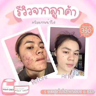 ครีมเทพหน้าใส ลดสิวหน้าใส 17g