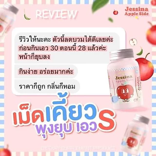 1 แถม 1 🍎 Jessina เม็ดเคี้ยวไฟเบอร์ กลิ่นแอปเปิ้ล ลดบวม ขับโซเดียม เร่งการเผาผลาญ ขับถ่ายคล่อง ลดเซลล์ลูไลท์