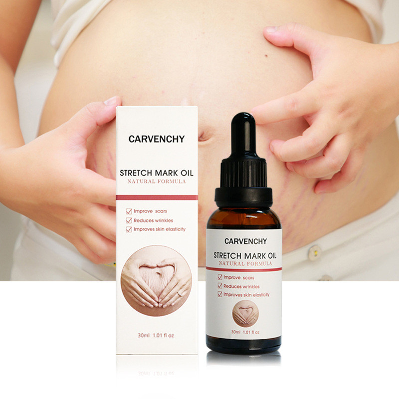 现货Stretch Mark Cream NATURAL FORMULA allowance de Toilette 按摩仪精油816