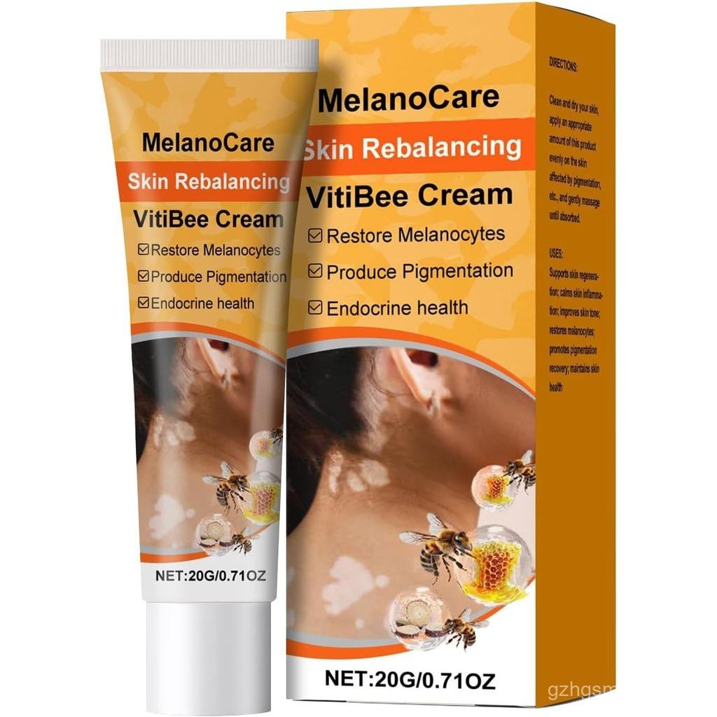 White Spot Removal Cream, Brightening Skin Lotion, Hydrating Face Cream, Targeted Spot Correction, W