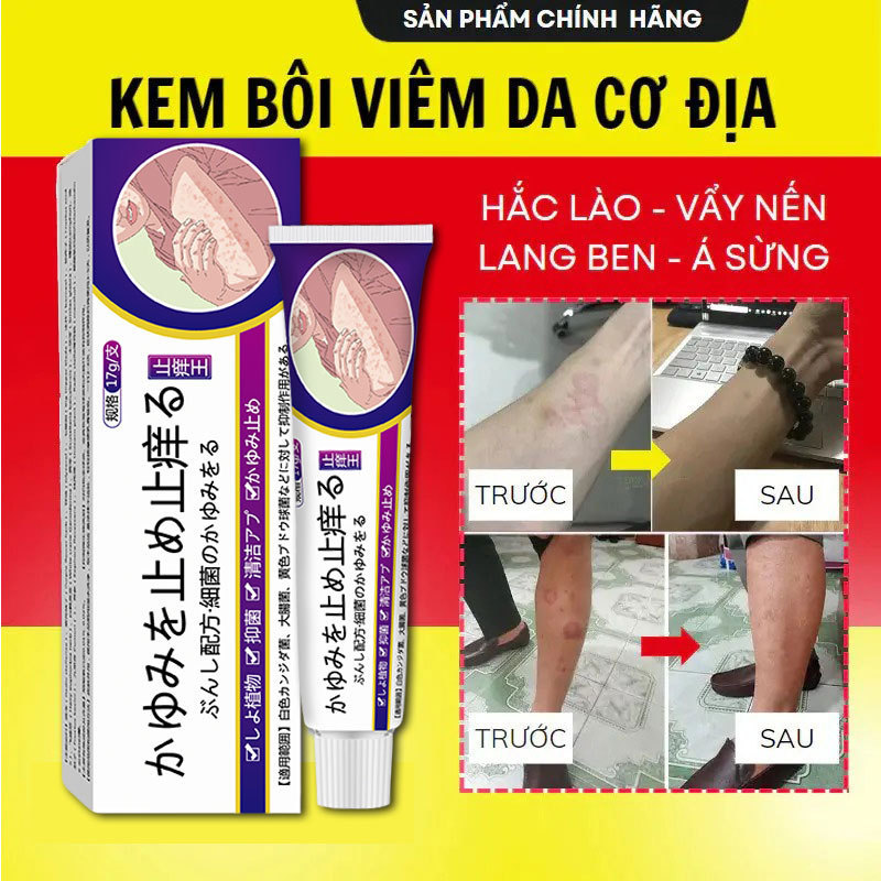 Japanese Anti-Itch King Skin Cream Anti-Itch Anti-Itch Anti-Itch Anti-Itch Anti-Itch Anti-Itch Anti-