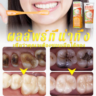 ยาสีฟันป้องกันฟันผุ ผสมฟลูออไรด์ ขจัดคราบ ลมหายใจหอมสดชื่น สูตรอ่อนโยนต่อเหงือก