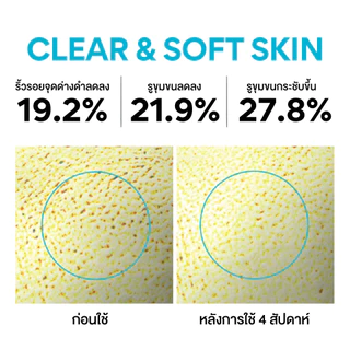 [รับฟรี 4 ชิ้น] (แพ็คคู่) Innisfree Double Retinol Cica Ampoule set 30 mlx2 อินนิสฟรี เรตินอลลดสิว