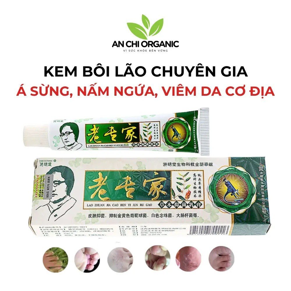 ครีมรักษา Keratosis Pilaris เชื้อราคัน Atopic โรคผิวหนัง กรีนลีฟ เอ็กซ์เพิร์ท 15g