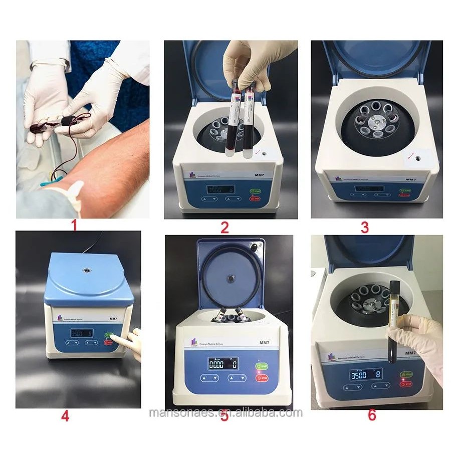 ใหม่ Blood Plasma Extractor PRP Dental Lab PRF Centrifuge Machine ขายร้อน