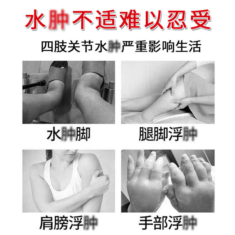 พร้อมสต็อก Fast Shipping Zou Runan ขจัด Edema สเปรย์คอไหล่เอวขา Joint Edema Discomfort สเปรย์สมุนไพร