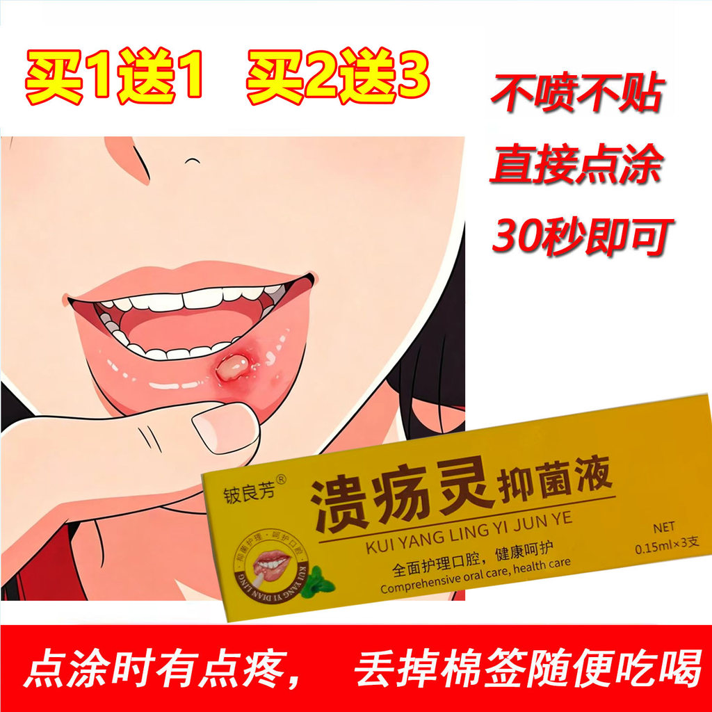 Beryllium กลิ่นหอม Ulcer Oral Ulcer เล็กๆน้อยๆ Ulcer สําลีทิ้งยา Swab สําลีปากไฟยาว