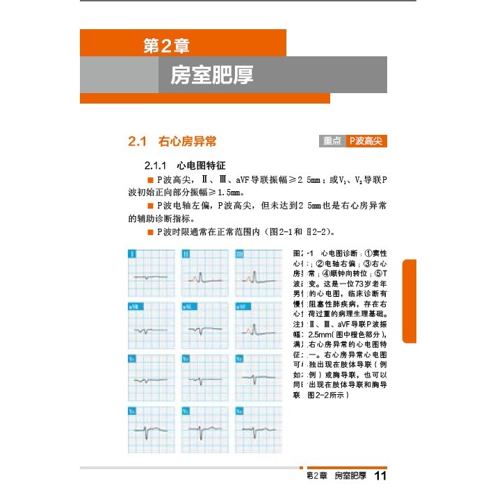 สีกระชับ ECG คู่มือ Clinical ECG Quick Start Medical ECG Diagnostic คู่มือตั้งแต่เริ่มต้น Proficient
