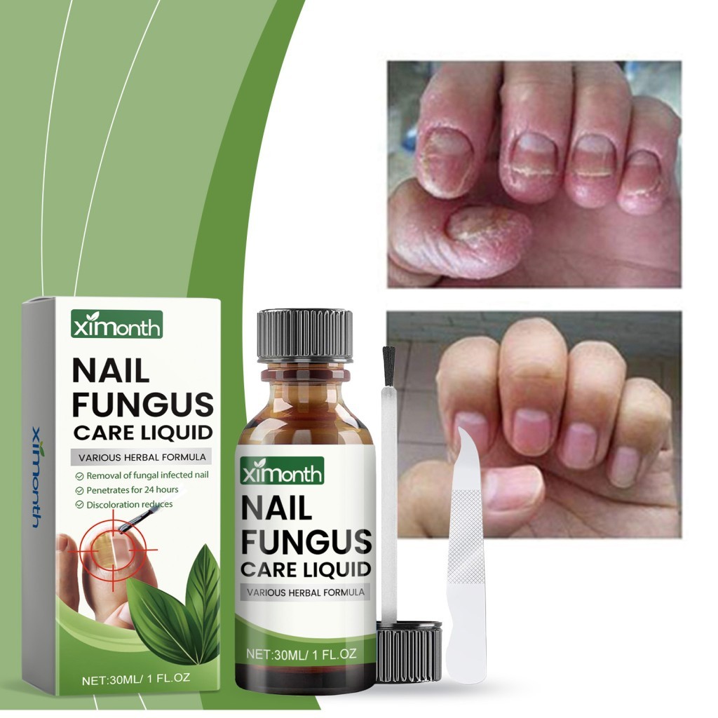 Ximonth Hand, Foot and Toenail Repair Kit Foot Nai Ximonth Mcha Plantrail Experitective Experize Sof