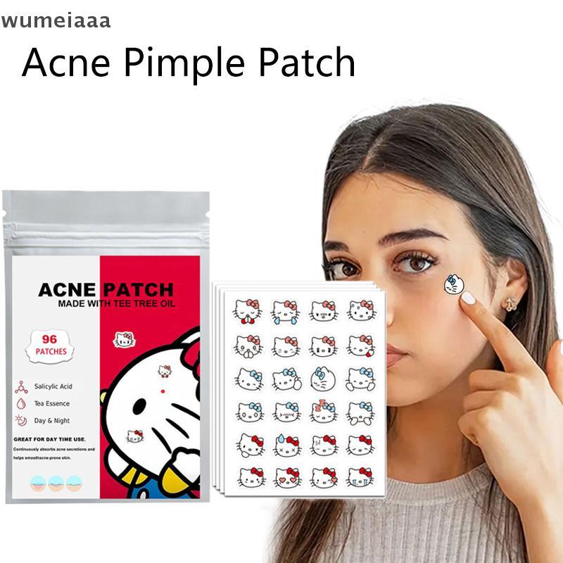 Wumeiaaaa 96 ชิ้น Hello Kitty Cat Repair Acne Patch บํารุงผิวหน้าจางฝ้าสิว TQ