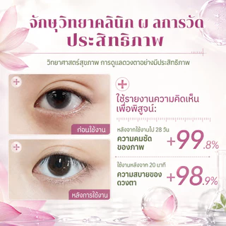ครีมบำรุงรอบดวงตาต่อต้านริ้วรอย ช่วยลดรอยคล้ำใต้ตา ขจัดอาการบวมและถุงใต้ตา ทำให้บริเวณรอบดวงตาสว่างขึ้น
