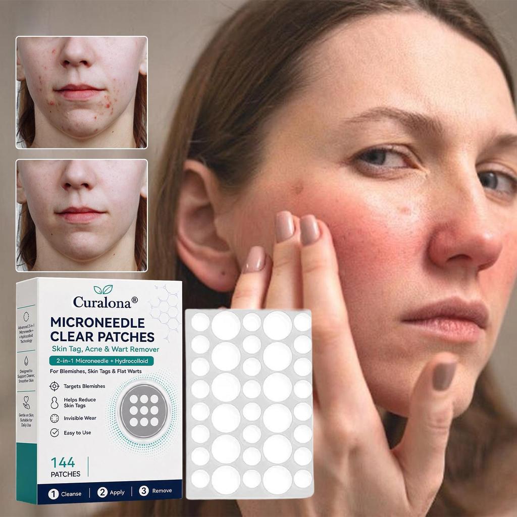 Microneedle Patch 144 ชิ้น Calming Microneedle Pads Skin Mark Remover สําหรับชายผู้ใหญ่เพื่อนครอบครั