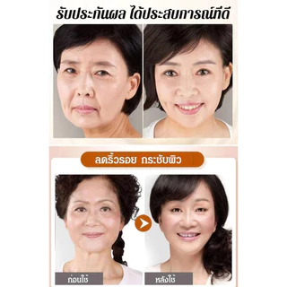 เซรั่มต่อต้านริ้วรอย กรดไฮยาลูโรนิก เปปไทด์โสม สารละลายนิโคตินาไมด์ เซรั่มบำรุงผิวหน้า
