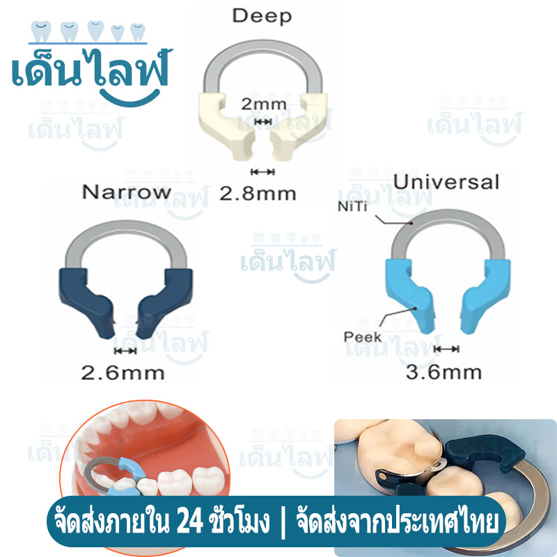 NITI Dental Matrix Bands Ring Garrison Style Matrix Clamp Clip โลหะ Matrices Matrix Clamp นิกเกิลไทเทเนียม Clamping แหว