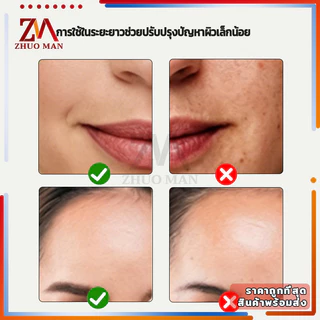 ซิริโคนนวดหน้า น้ำแข็งนวดหน้า ลูกกลิ้งซิลิโคนทำน้ำแข็งสำหรับผิวหน้า ice rollerอุปกรณ์นวดหน้า ใช้ซ้ำได้ ช่วยเฟรชผิวให้ปัง