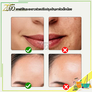 ซิริโคนนวดหน้า ลูกกลิ้งผิวหน้าช่วยลดบวม น้ำแข็งนวดหน้า อุปกรณ์นวดหน้า ใช้ได้ทั้งผิวหน้าและร่างกาย ใช้งานง่าย