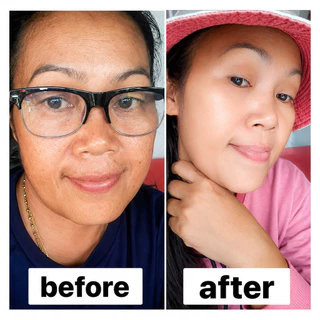 ซื้อ 2 แถม 1🔥Kimchi Face Cream ครีมกิมจิ 30 เดย์ พลัส จุลินทรีย์เข้มข้น ครีมกิมจิ ลดฝ้า กระ รอยสิว จุดด่างดำ