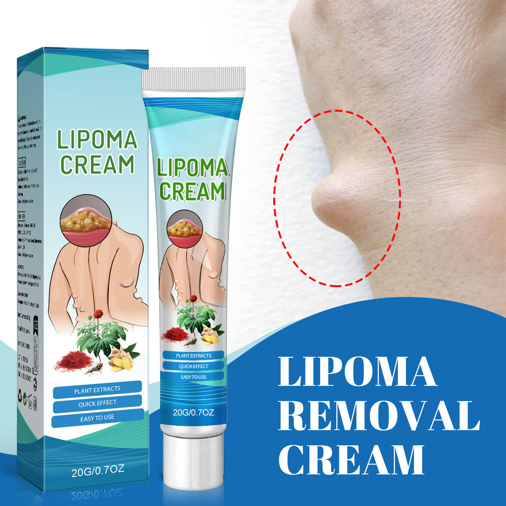 LIPOMACREAM Lipid แคลคูลัสบรรเทา Lipid แคลคูลัส Tumor ผิวบวมบล็อก Dredge หลวม Knots Body Care8989202