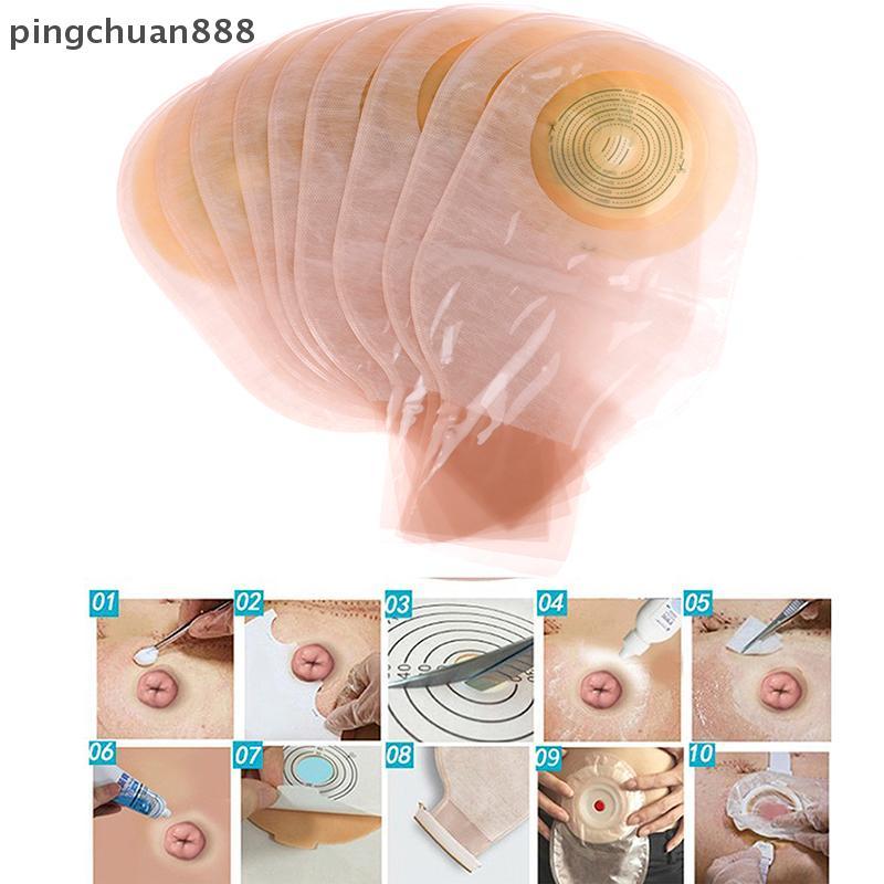 Pingchuan888 10X One-piece System Coลอสโตมี่กระเป๋าทิ้งOstomy Drainable Single Pouch Kit Nice