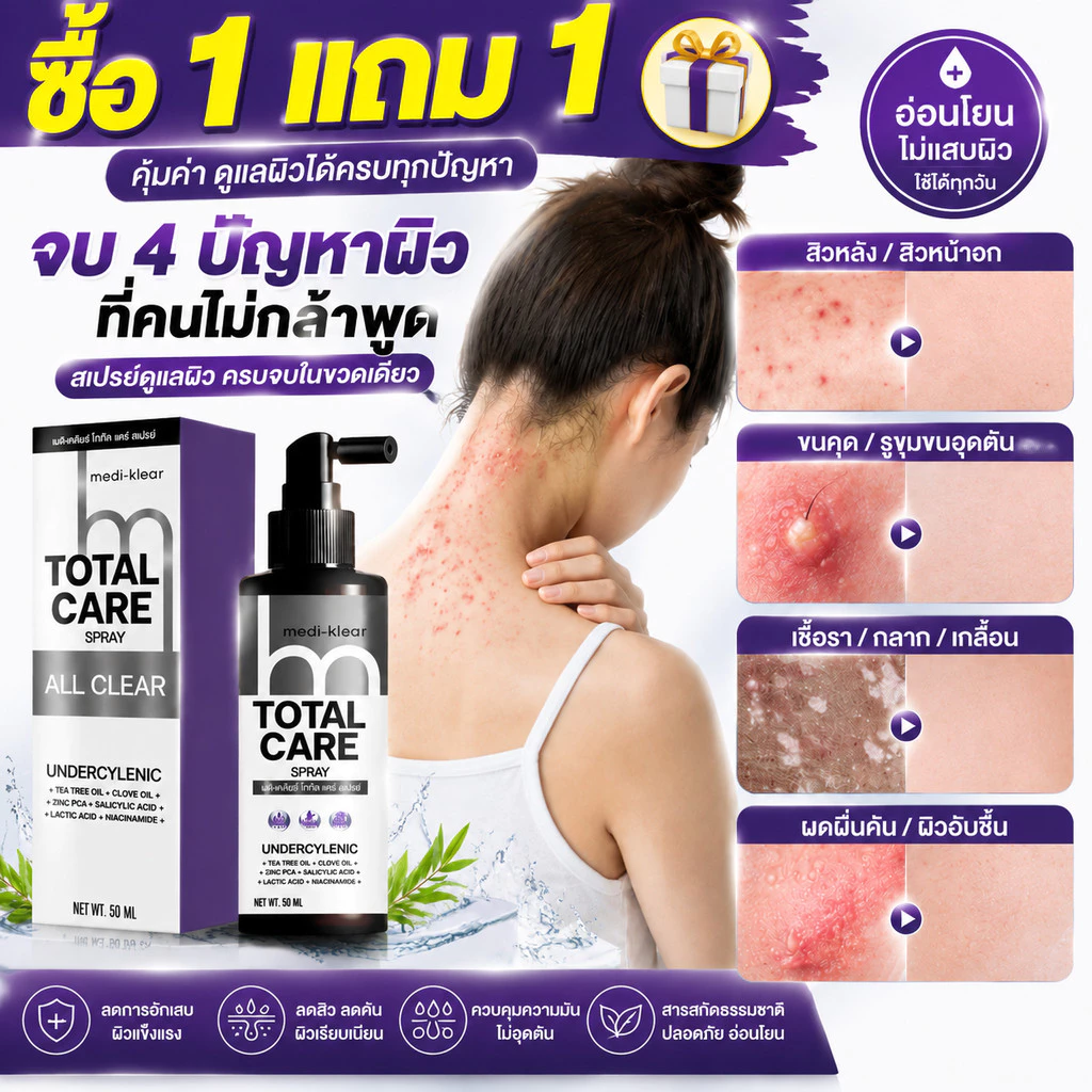 ซื้อ 1 แถม 1 Medi-Klear สเปรย์ดูแลผิว 50ml สำหรับสิวหลัง ขนคุด ผื่นคัน ผิวเป็นสิวง่าย