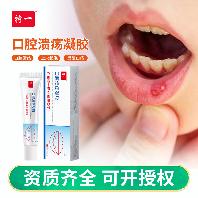 [คลังสินค้าพร้อม] เจล Ulcer Oral Ulcer Oral Ulcer หักฟื้นคืนชีพไฟบนลิ้นปากฟอง Healing Oral Ulcer Oin