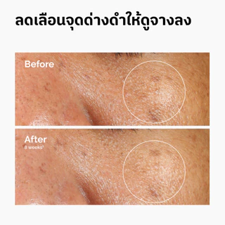 The Ordinary Alpha Arbutin 2% + HA 30mL | เซรั่มลดจุดด่างดำ ผิวกระจ่างใส สีผิวสม่ำเสมอ เรียบเนียน