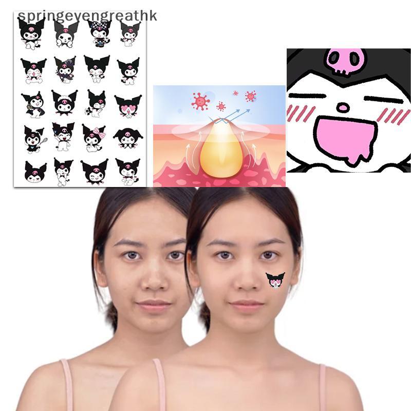 SPING 96 ชิ้น/เซ็ต Kuromi สิว Patch สิวที่มีสีสันที่มองไม่เห็น Skin Care Stiers คอนซีลเลอร์ Face Spo