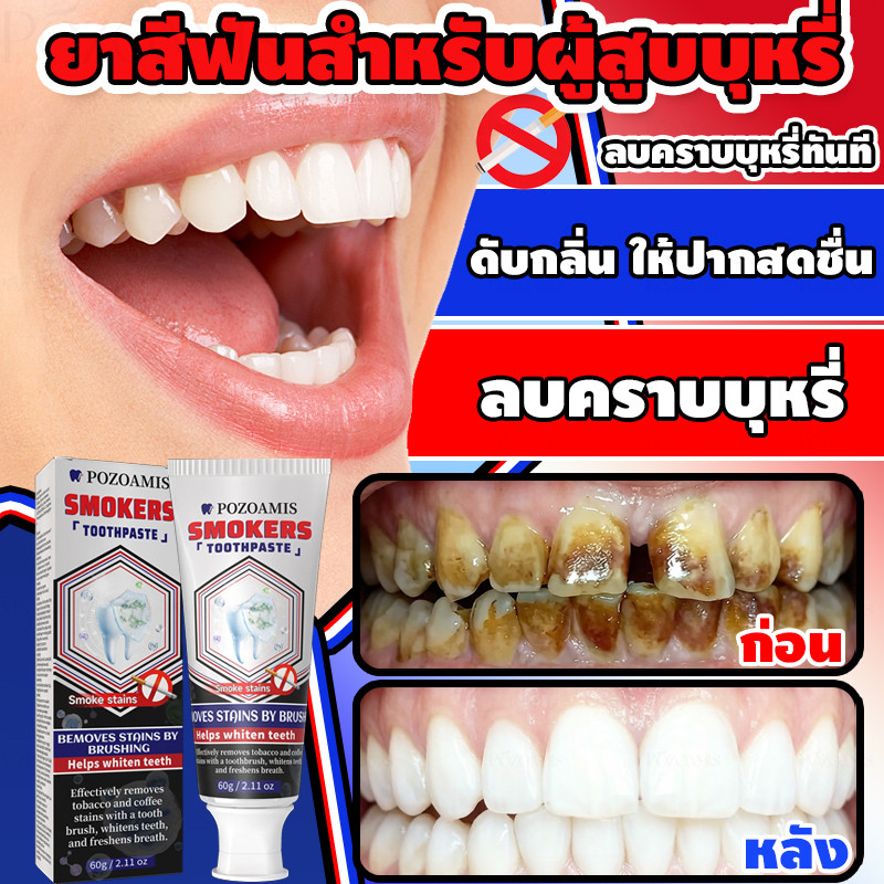 ยาสีฟันไวท์เทนนิ่ง ขจัดคราบและฟันเหลือง ฟันขาว ขจัดคราบยาสูบ ซ่อมแซมฟัน ป้องกันฟันผุ ลดกลิ่นปาก ลมหายใจสดชื่น เหมาะสําหรับ