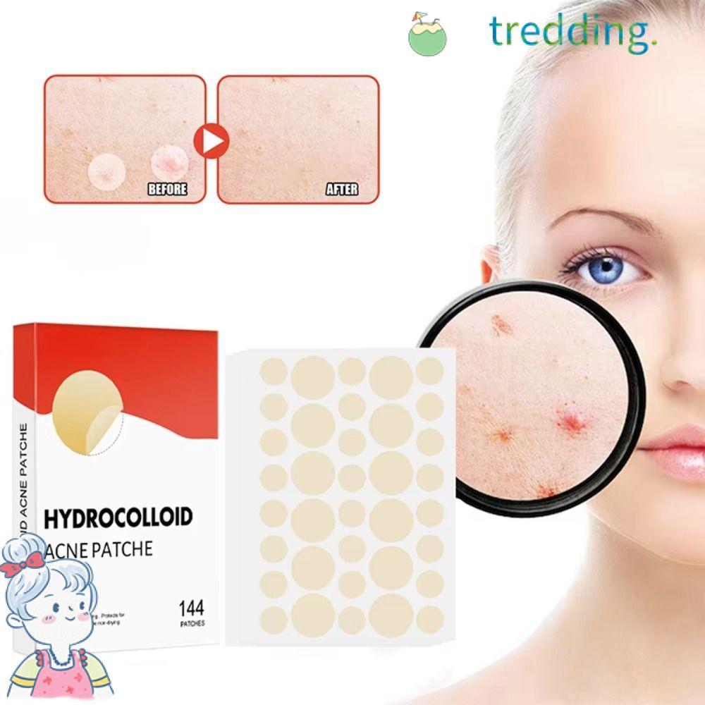 TREDDING491 แพทช์กําจัดสิวที่มองไม่เห็น, การกําจัดสิว Anti-Acne Acne Pimple Patch, กันน้ําทรงกลม Hyd