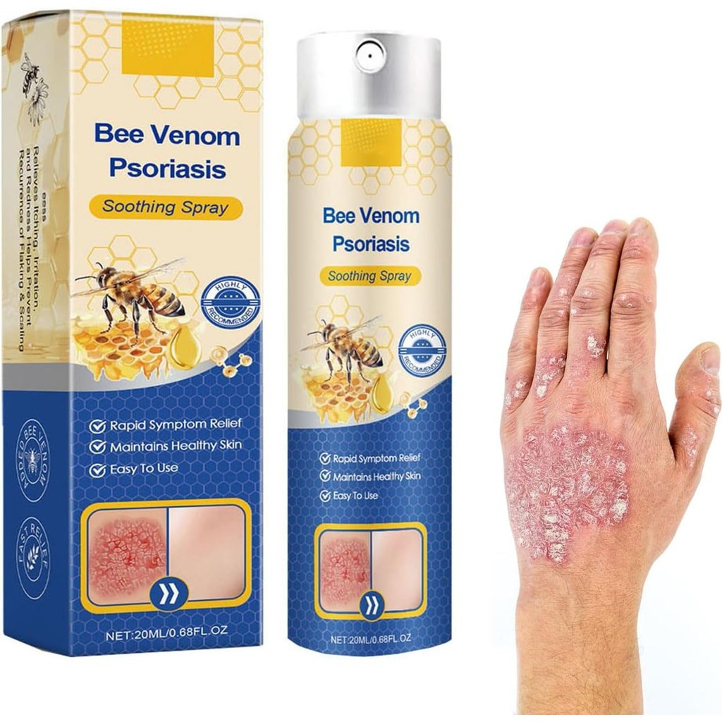 1/2/3 ชิ้น Bee Venom Psoriasis Treatment Spray, Psoriasis with Bee Venom, Bee Venom Treatment Spray,