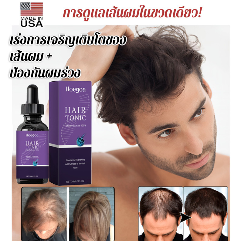 แฮร์เซรั่มปลูกผมใหม่สูตรเข้มข้น/ฟื้นบำรุงหนังศีรษะ/ป้องกันผมบางผู้ชายผู้หญิง/ดูแลสุขภาพเส้นผมและหนังศีรษะให้แข็งแรง/ใช้ง่ายในชีวิตประจำวัน