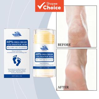 ครีมทาเท้าให้ความชุ่มชื้นล้ําลึก 30 กรัม ผสมยูเรียและกรดซาลิ…