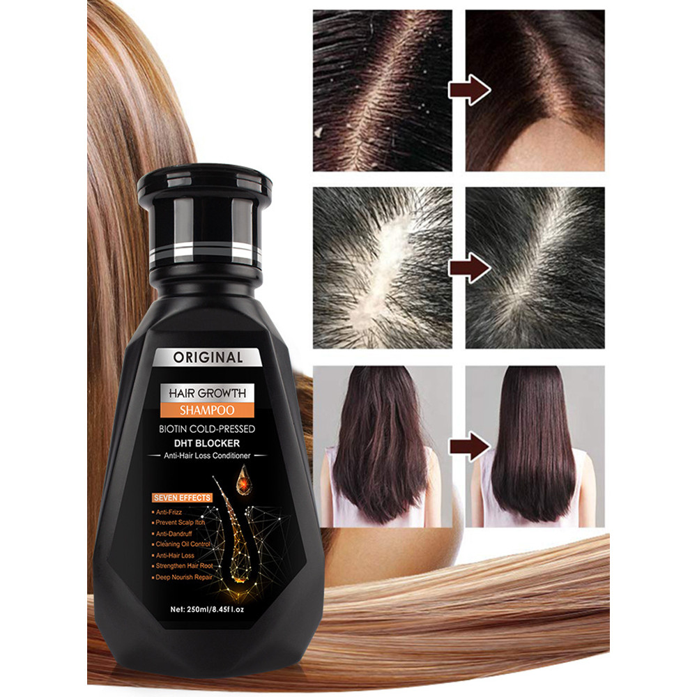 น้ํามันหอมระเหยการเจริญเติบโตของเส้นผมBiotin Cold Press DHT Stagnant and Growth Shampoo Anti-Hair Lo