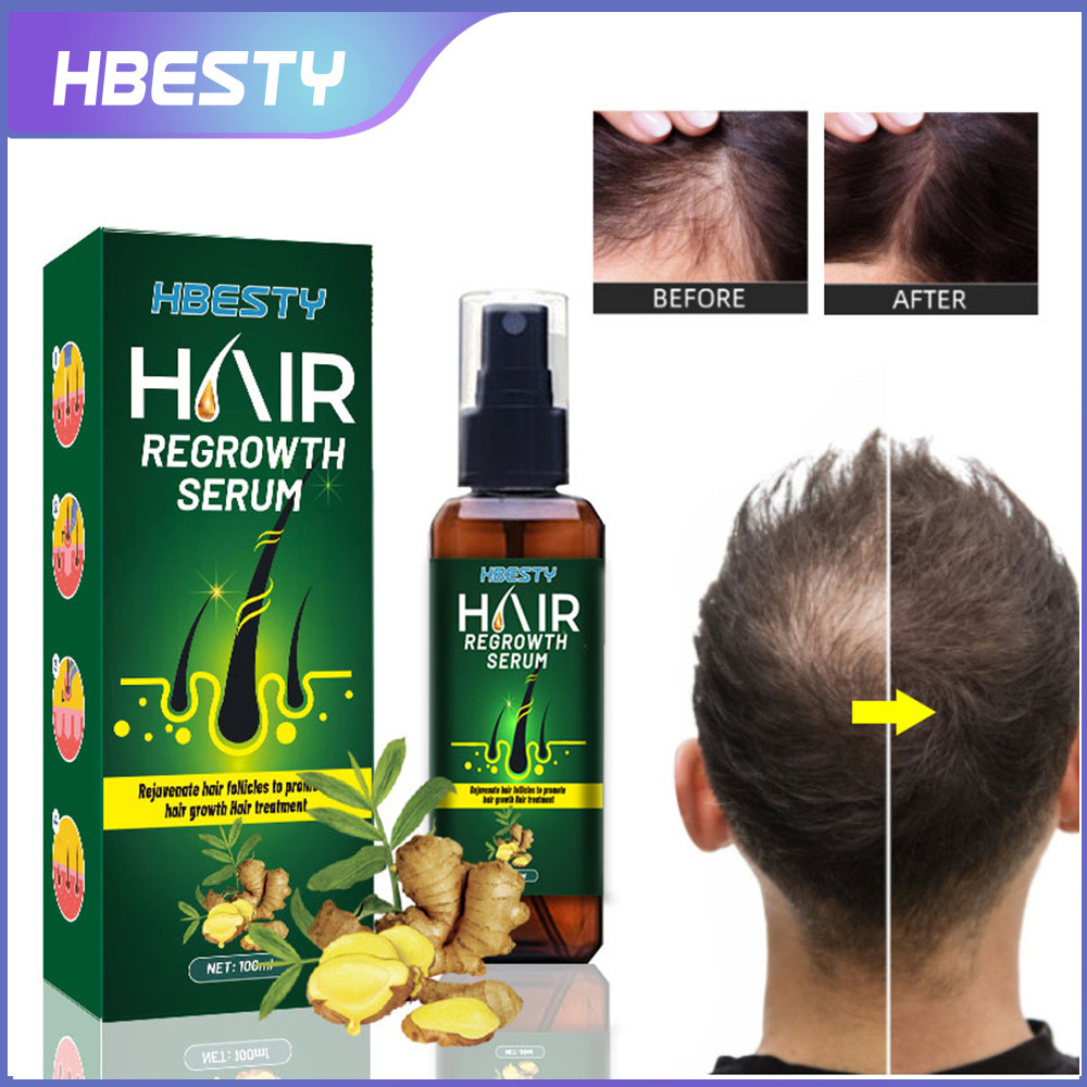 HBESTY Ginger Hair Density Lotion Moisturizing Hair Follicle Hair Lotion Density Hair Long Hair Blac