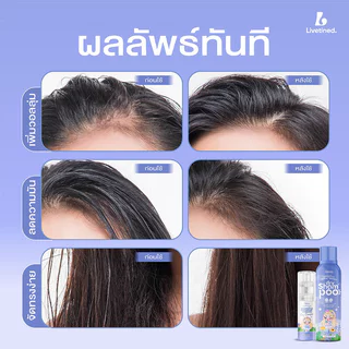Livetined Hairona Cooling Fresh Water-Based Dry Shampoo 160ml สเปรย์แชมพูสระผมแบบแห้ง ลีฟทิเนด ช่วยลดผมมันนาน หอมสะอ...