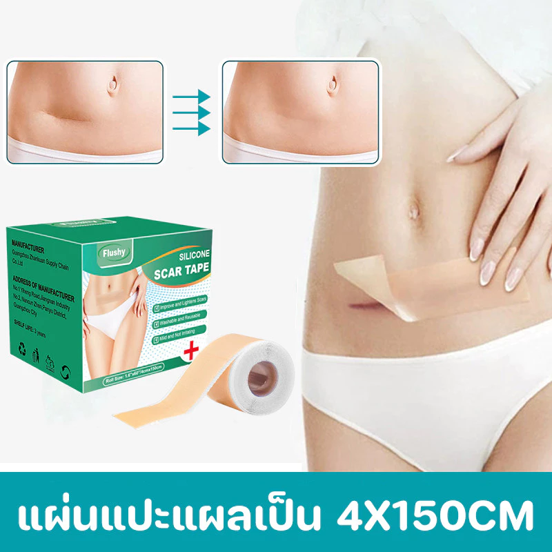แผ่นแปะแผลเป็น ซิลิโคนรอยแผลเป็นแผ่น 1 ม้วน (4X150 ซม.) กําจัดรอยแผลเป็นจากแผลเป็น กันน้ำ