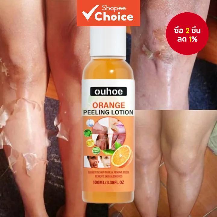สีเหลือง Peeling Oil Bleaching Face Body Dark Skin Brighten Whiten โลชั่นมือเท้า Dead Skin Peel Exfo