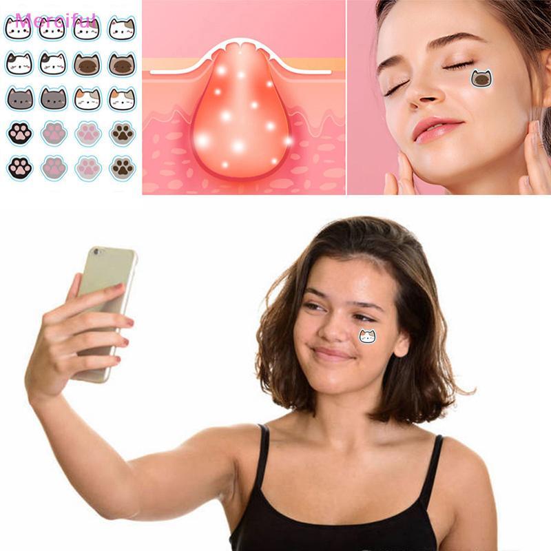 [Mer] 96 ชิ้น Cats Paw Acne Pimple Patch Stier Treatment Pimple Remover Tool Blemish Spot Facial Mas