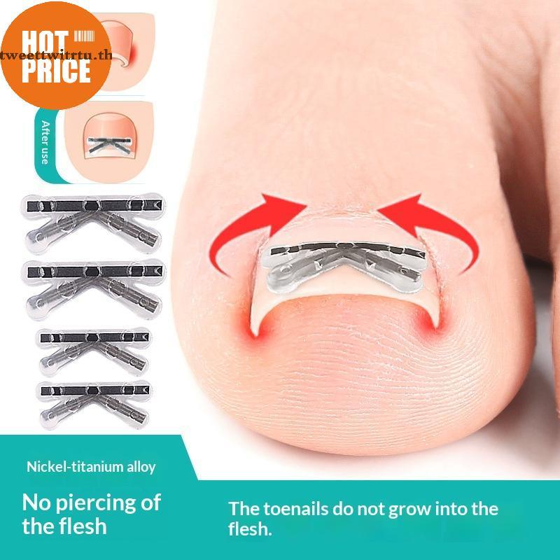 TRTU 2 ชิ้นคุด Toenail Corrector Pedicure กู้คืน Embed Toe Nail Treatment Professional คุด Toenail C