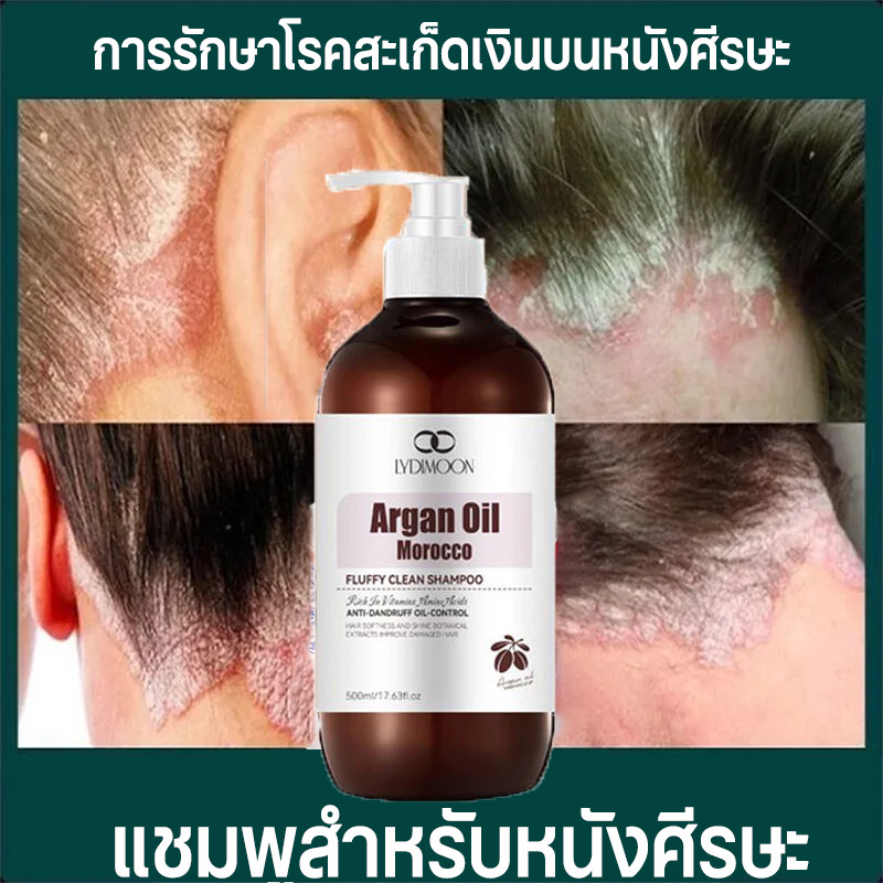 LYDIMOON แชมพูขจัดรังแค ยาสระผมแก้คันหนังศรีษะ 500ML  บำรุงรากผม สูตรอ่อนโยน