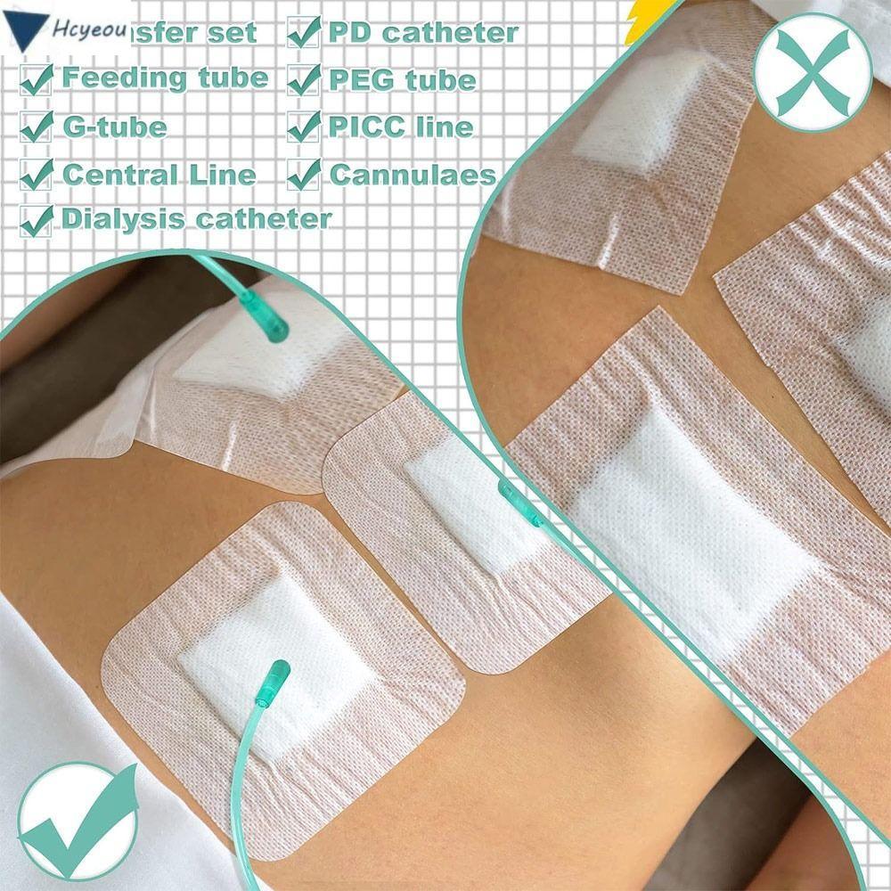 HCYEOU 10pcs Chest Catheter Cover, Gtube Supplies Wound Bandage Feeding Tube Pad, Replacement Perito