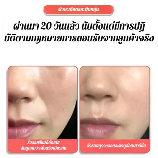 ซื้อ 1 แถม 3✨【ฟื้นฟู/กระชับผิวยามค่ำคืน】 แผ่นแปะกระชับผิวและลดริ้วรอยร่องแก้ม/กระชับผิวและลดริ้วรอย 2-in-1/แผ่นแปะบำรุงผิวล้ำลึก/เหมาะสำหรับผู้ที่มีริ้วรอยลึก
