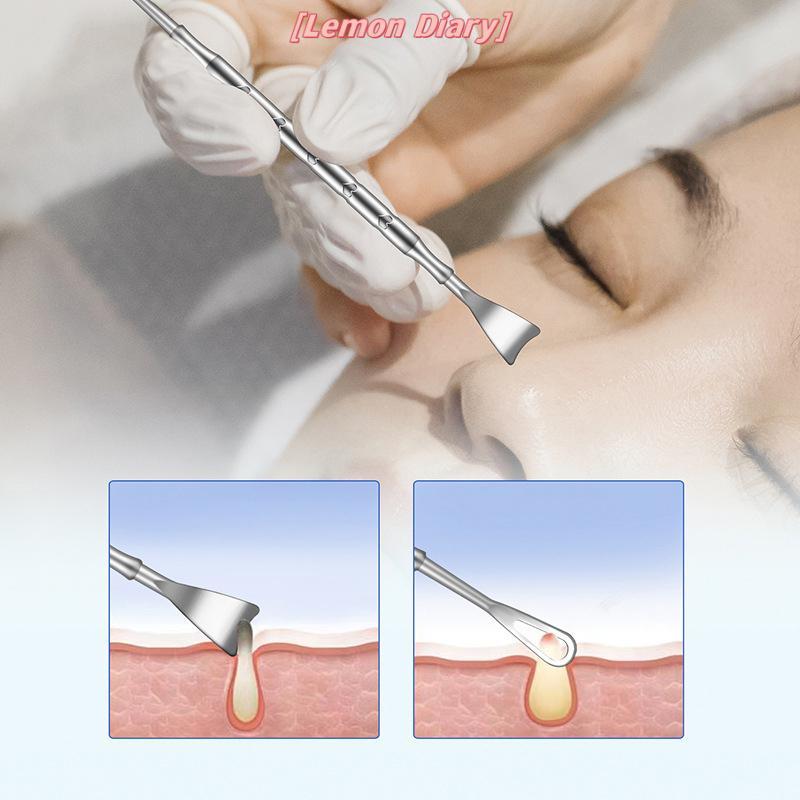 แอลดี| Remover Pimple Popper Tool Removing Treatment Whitehead Popping Zit Nose Face Blemish Extract