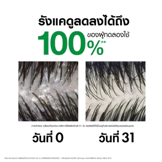 [เซตสุดคุ้ม] วิชี่ VICHY DERCOS ANTI-DANDRUFF SHAMPOO แชมพูขจัดรังแค ป้องกันการกลับมาเป็นซ้ำ 390ml x 3ชิ้น