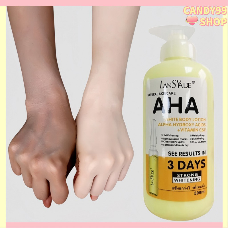 บำรุงผิว Body Lotion กรดผลไม+VC&E คลีมทาผิว โลชั่นผิวขาว ทาผิวขาว ผิวขาวใส ฟื้นฟูผิวแห้งเสียให้อิ่มน้ำ 500ML