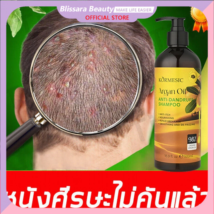 แชมพูขจัดรังแค 500MLยาสระผมเชื้อรา ป้องกันรังแคและลดความมัน บำรุงหนังศรีษะ ลดอาการคันศีรษะ ลดรังแค แชมพูขจัดรังแค